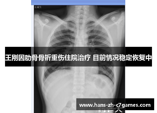 王刚因肋骨骨折重伤住院治疗 目前情况稳定恢复中